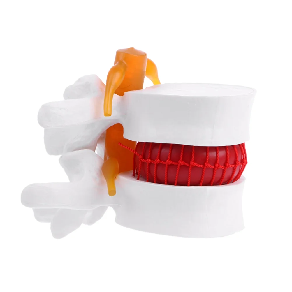 

Mannequins Human Spine Model Lumbar Vertebral Pathology Medical Training Anatomy White Pvc Doctor
