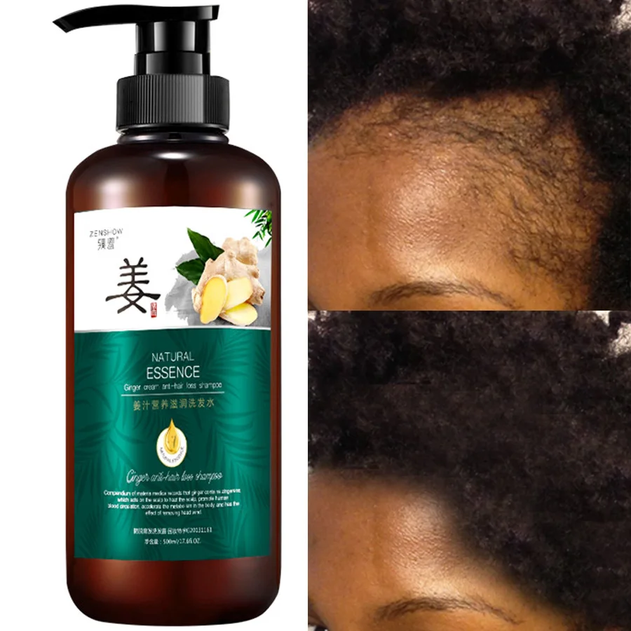 

500ml/16.9FL.OZ Ginger Shampoo Moisturizing Repair Damaged Refreshing Oil Control Strong Root Healthy Hair Gentle Hair Care