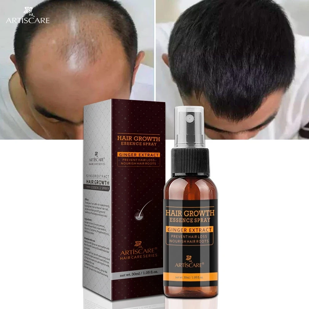 

ARTISCARE Hair Growth Essence Spray Anti Hair Loss Treatment Essential Oil Preventing Baldness Consolidating Nourish Roots Hair