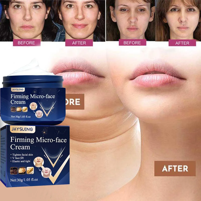 

Firming Face-lift Slimming Cream V-Shape Slimming Removal Masseter Muscle Double Chin Face Fat Burning Anti-aging Products 30g