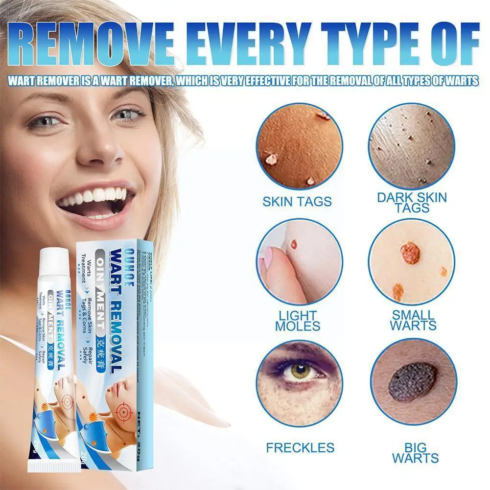 

Wart-removing Cream To Repair Yuke's Body, Skin Products Products Skin Skin And Neck Whitening Care Face Whitening M1k4