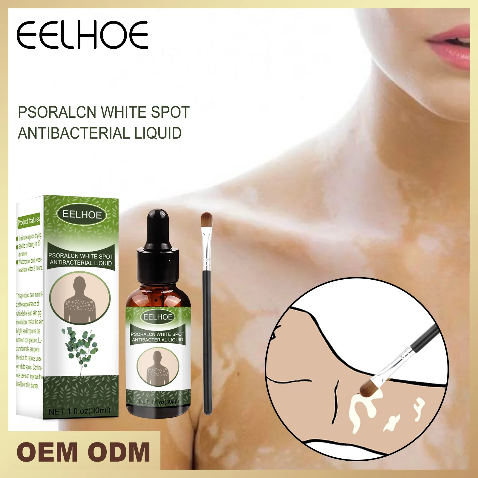 

30ml White Spot Remover Spray Antibacterial Liquid Skin Mottled Vitiligo Essence Leukoplakia Treatment Skin Care Repair Tool