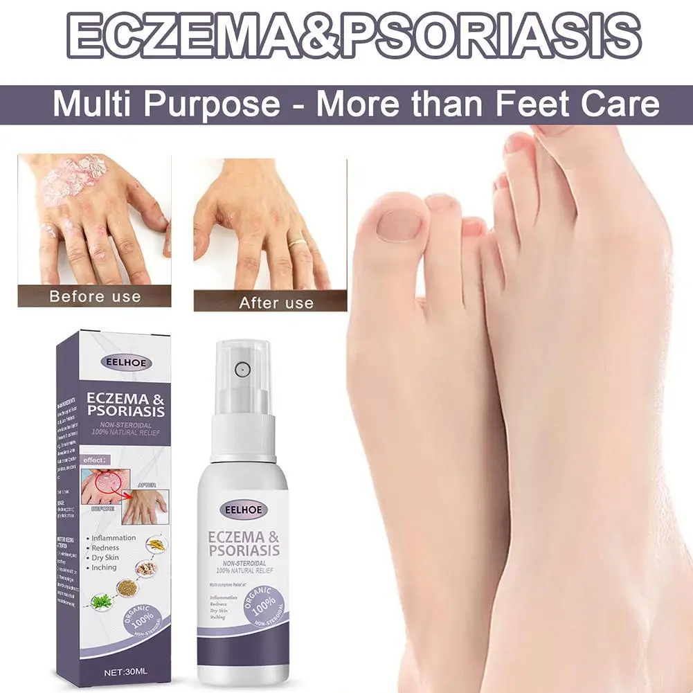 30ml Skin Ringworm Spray Relief Feet Skin Itching Scaling Redness Topical Skin Care Spray