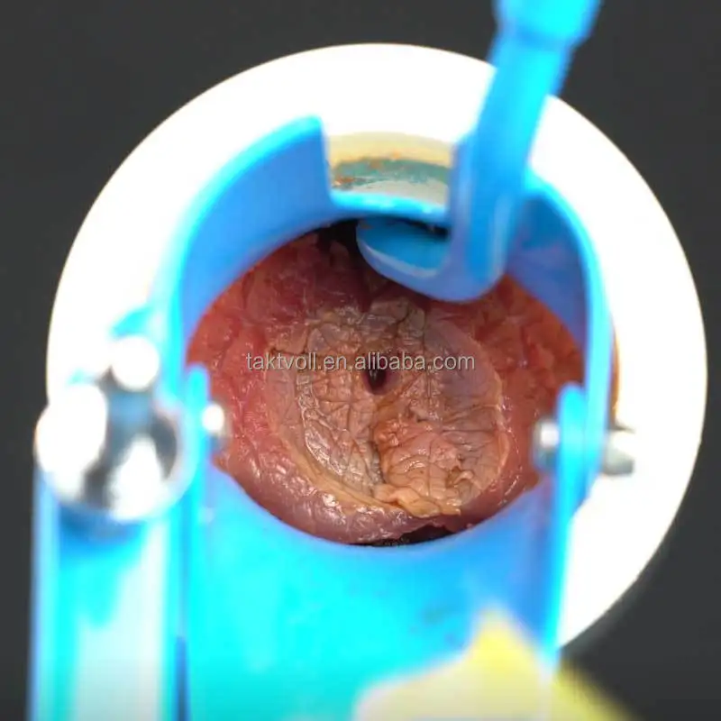 Лучшая цена электрохирургический Lletz Круглый электрод Ce хирургическая камера