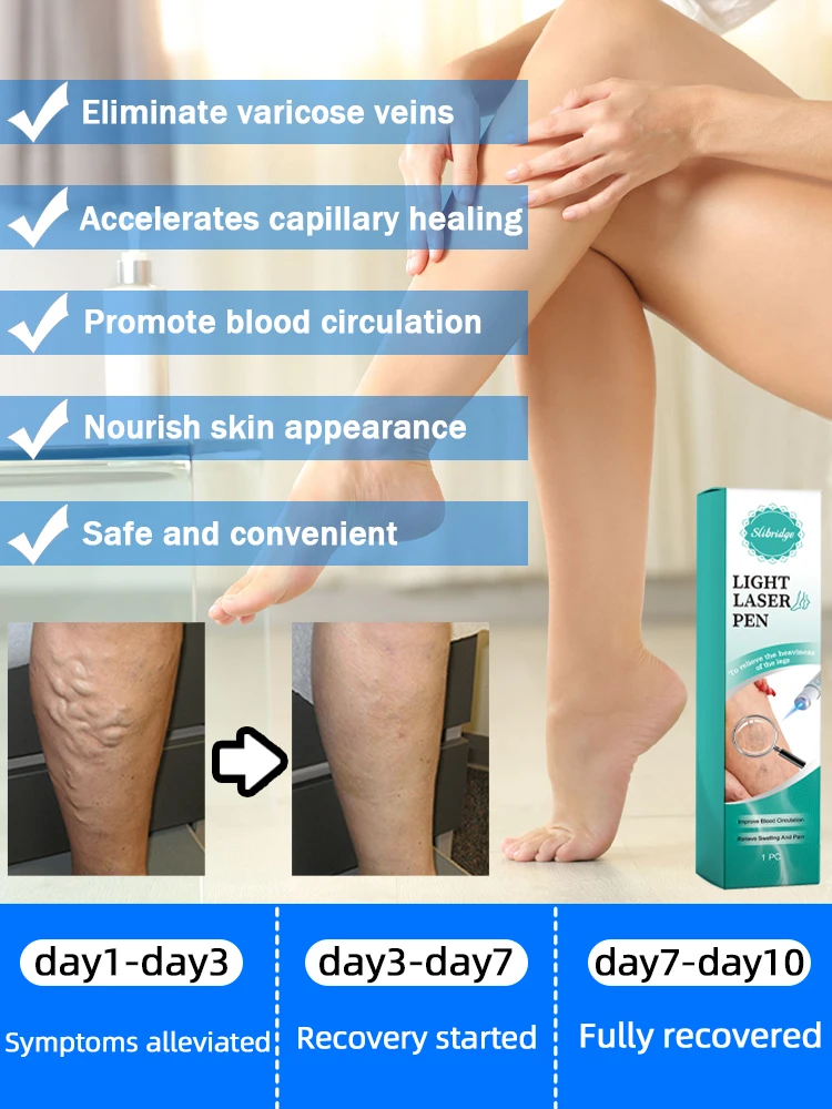 Крем-лазер Varicosse