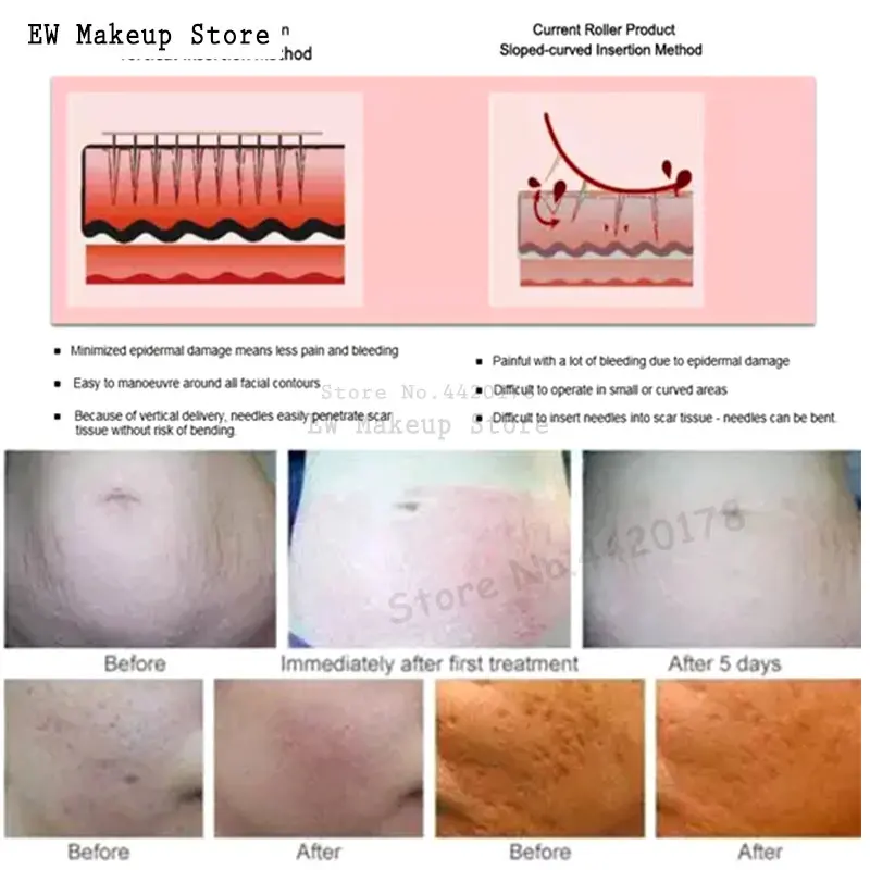 Рисунок 5 - одноразовые картриджи для татуажа
