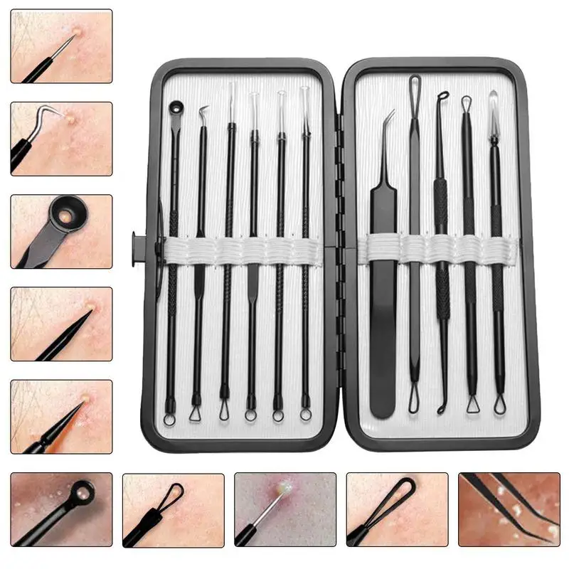 

Инструменты для удаления черных точек, 11 шт., набор для удаления черных точек, комедонов