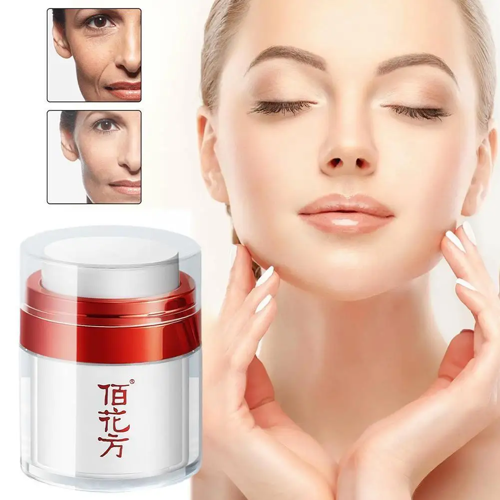 

Dark Spots Whitening Cream Brightening Melasma Pigmentation Cream Acne Whitening Face Blemishes Marks Women E8O4