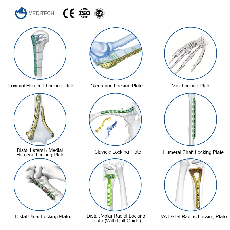 Заводская цена набор инструментов с фиксирующей пластиной Meditech комплект для