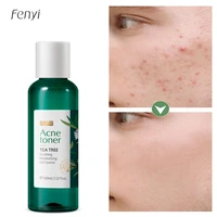 effective tea tree acne treatment face toner blackhead remover shrink pores oil control whitening moisturizing korean cosmetics