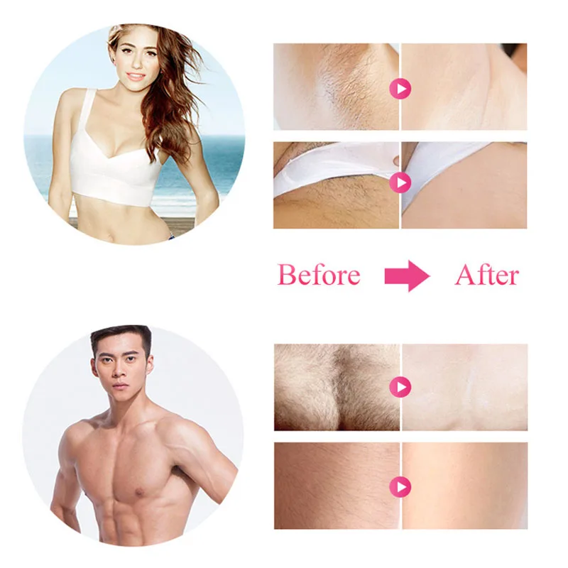 IPL лазерное удаление волос 600000 вспышка Эпилятор с ЖК-дисплеем для женщин и мужчин