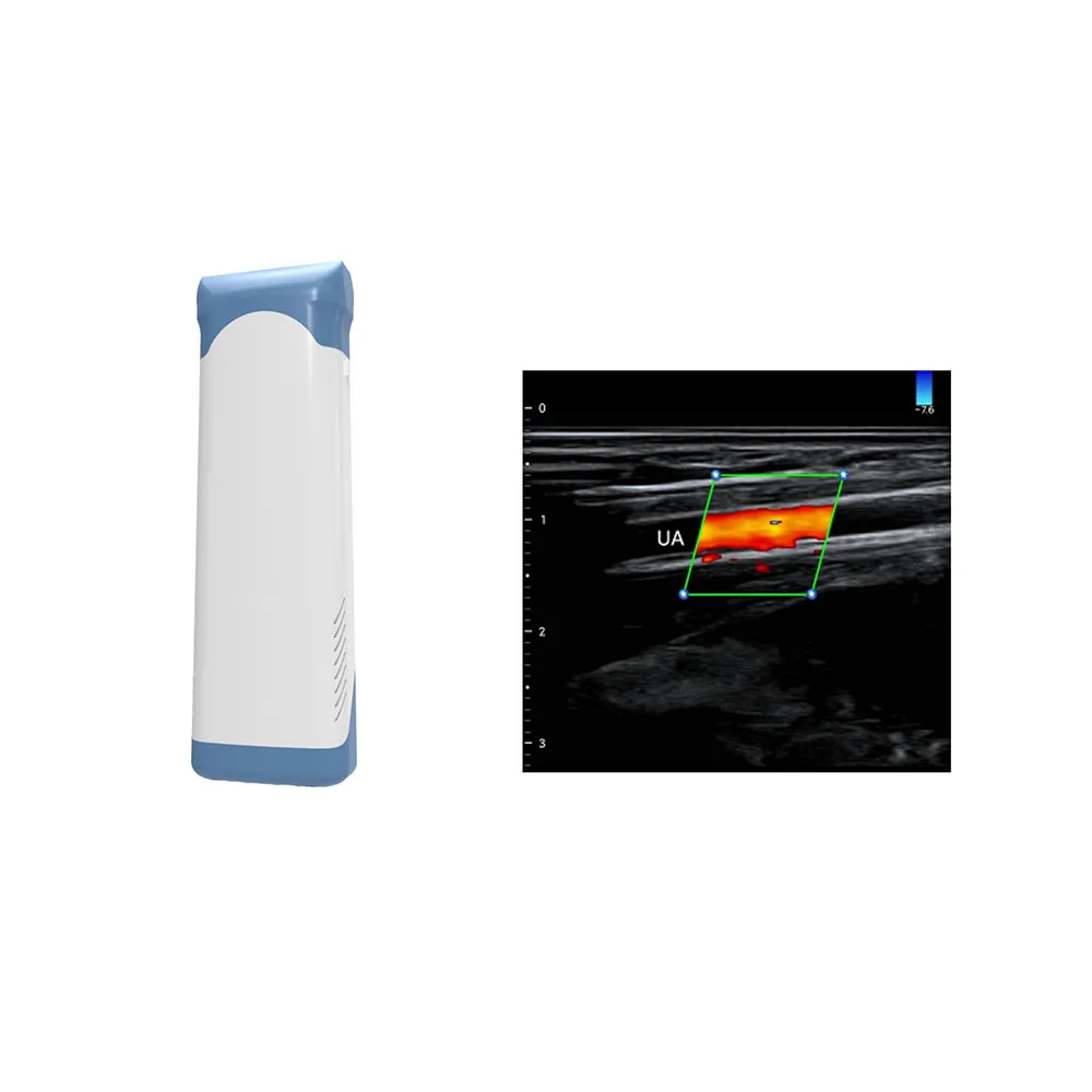 

Amain Highest Cost-effective Portable Ultrasound Device MagiQ HL Pro Wireless Color Doppler Ultrasound Scanner