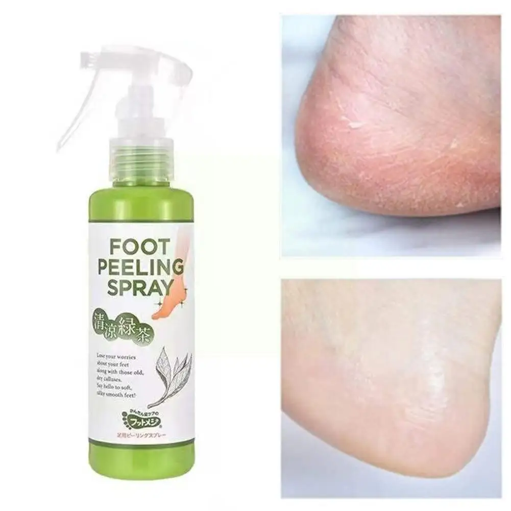 

110ml Green Tea Foot Peeling Spray Hydrating Nourish Spray Skin Peel Tea Essence Green Dead Care Off Spray Natural Foot Ped T2r8