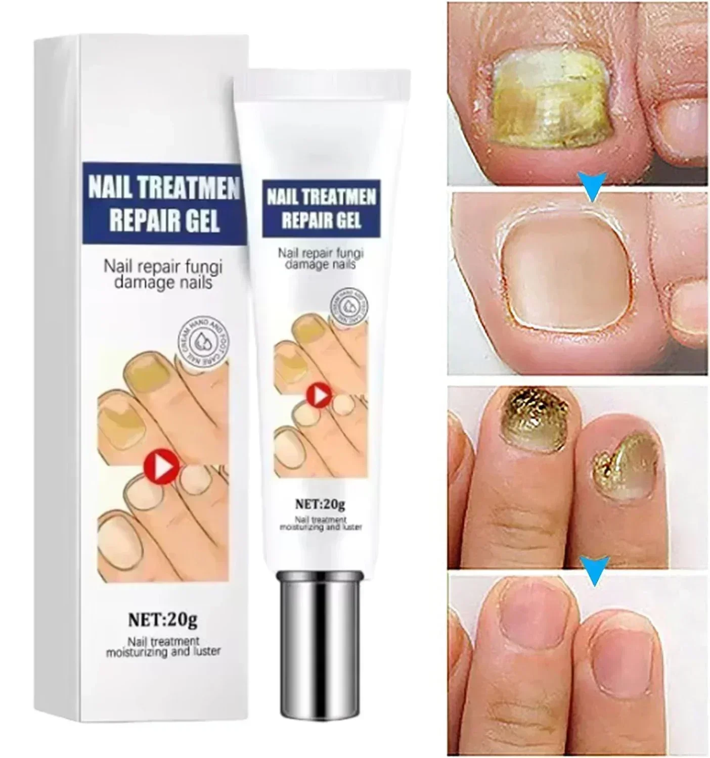 ГОРЯЧАЯ ПРОДАЖА восстановление грибка ногтей ремонт для обесцвеченных