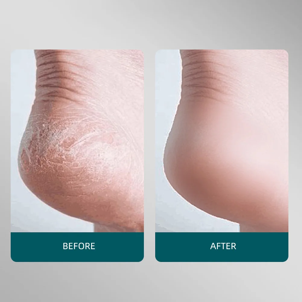 1 шт. шлифовальная машинка для ног с защитой от брызг удаление омертвевшей кожи