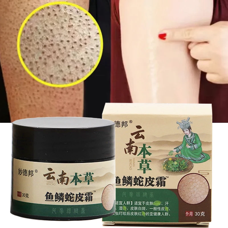 

Repair Chicken Skin Cream Curing Body Dark Spot Keratosis Follicle Pilaris Remove Thick Pore Moisturizing Smoothing Skin Care