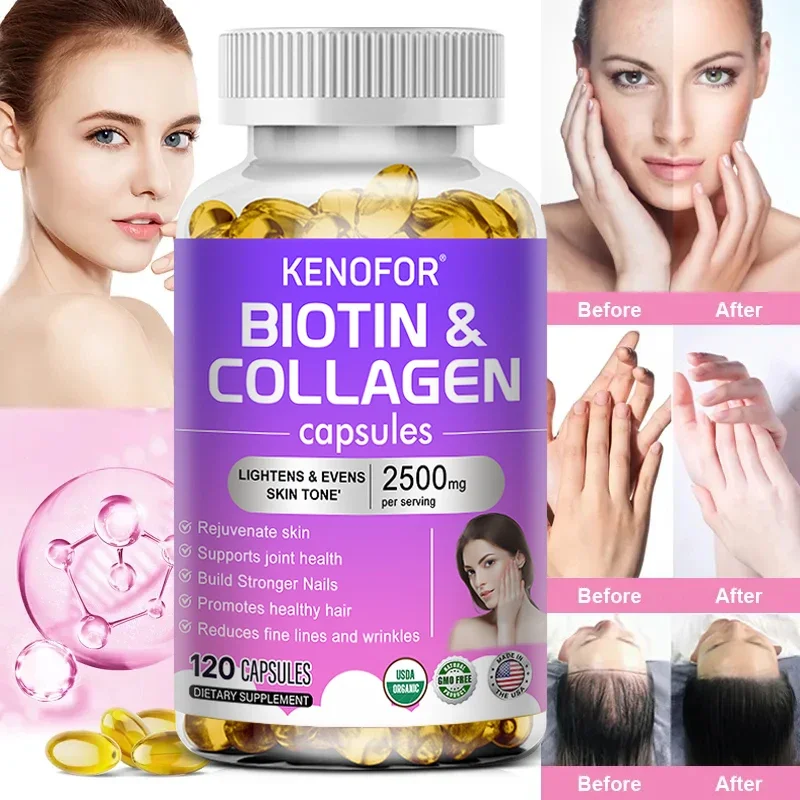 

KENOFOR Collagen Beauty Booster Promotes Hair Health, Skin Whitening, Fades Fine Lines, Radiant and Anti-aging.