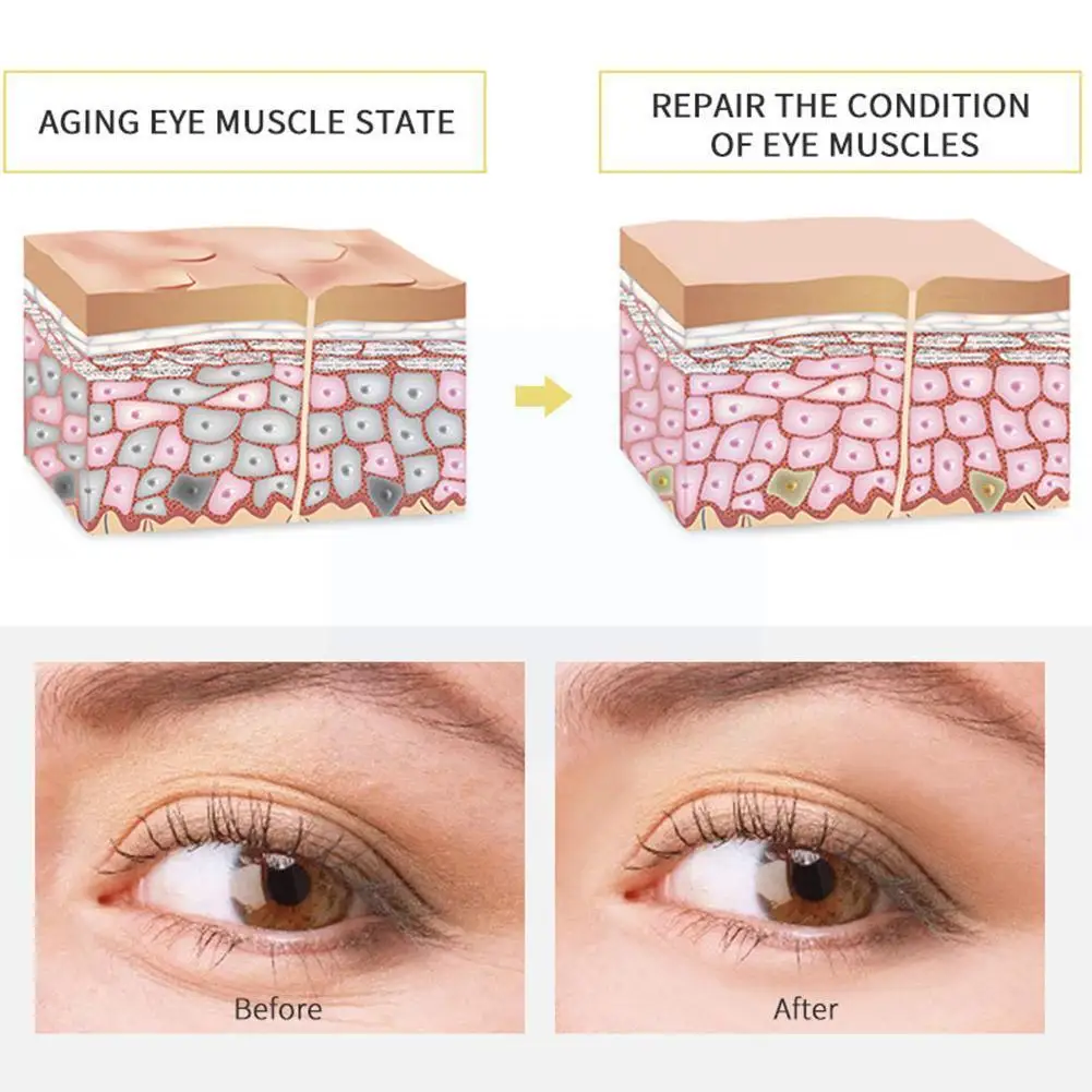 

Anti Dark Circle Eyes Care Cream Eye Bags Removal Wrinkle Contour Cream Serum Aging Moisturizing Massage Banana Eye Anti Ma T5r9