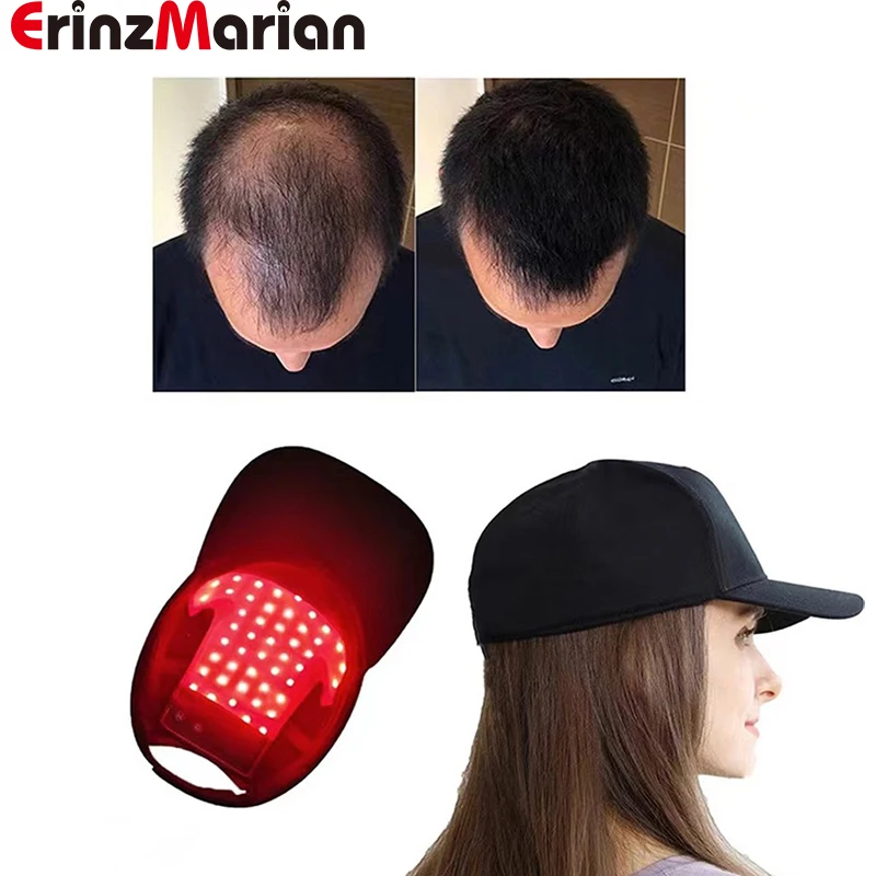 LED Red Light Therapy Cap Hair Growth Hat Red Infrared Light Therapy Device for Hair Loss Treatment USB Charging