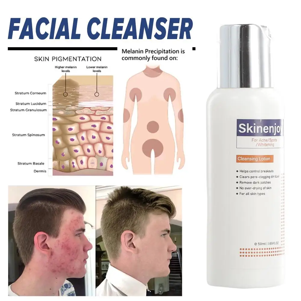 

Whitening Facial Cleanser Fade Dark Pigmentation Dullness Skin Brighten Deep Cleaning Moisturizing Lotion Cleansing Exfolia T9Y6