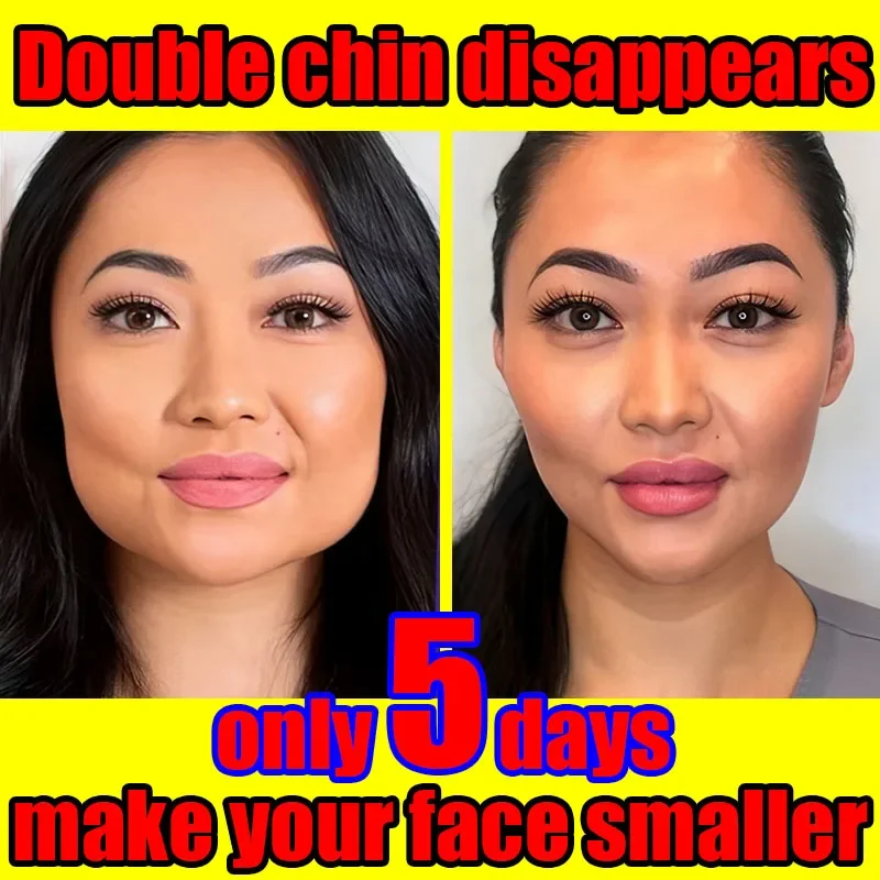 Crema de Plateit до индивидуального разделения с зазубринами. ЭМ для удаления двойного