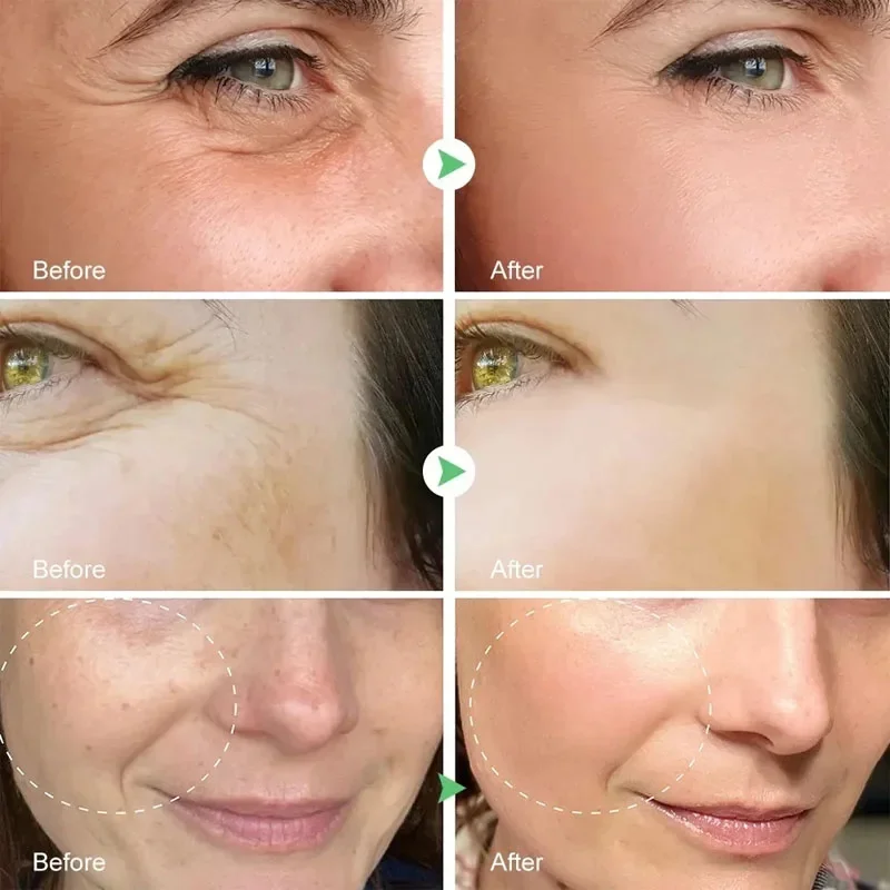 Капсулы с гиалуроновой кислотой сыворотка тонкими линиями против морщин