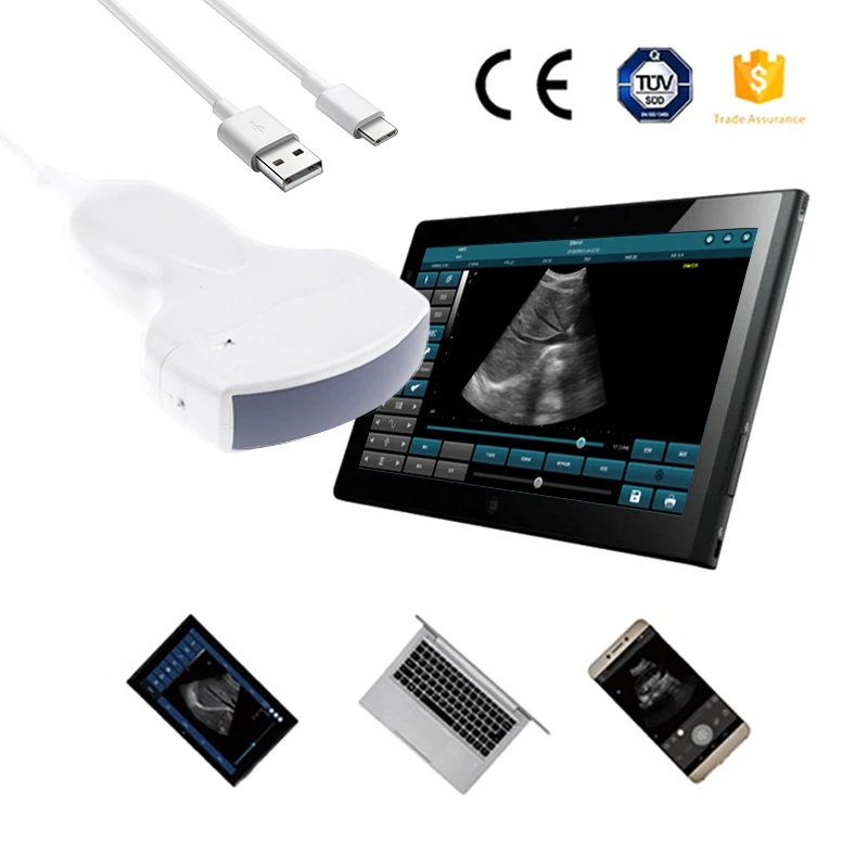 

Wh-1 Medical Ultrasound Instruments ecografo portatil Machine Of Multiple Organs Portable Wired Handheld Ultrasonic Scanner