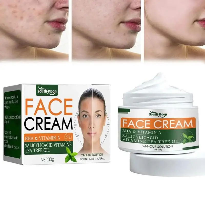 

Уход за пятнами, крем, уход за пятнами, уход за пятнами, крем, средство для удаления прыщей и пятен для лица и тела, угрей, отбеливания, Zit