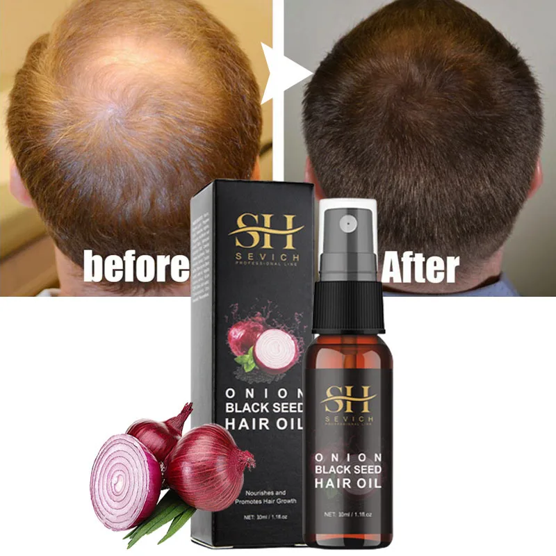 Onion Hairs Growth Essential Oil Fast Growing Products Alopecia Liquid Spray Prevent Loss Damaged Repair Scalp Treatment Beauty