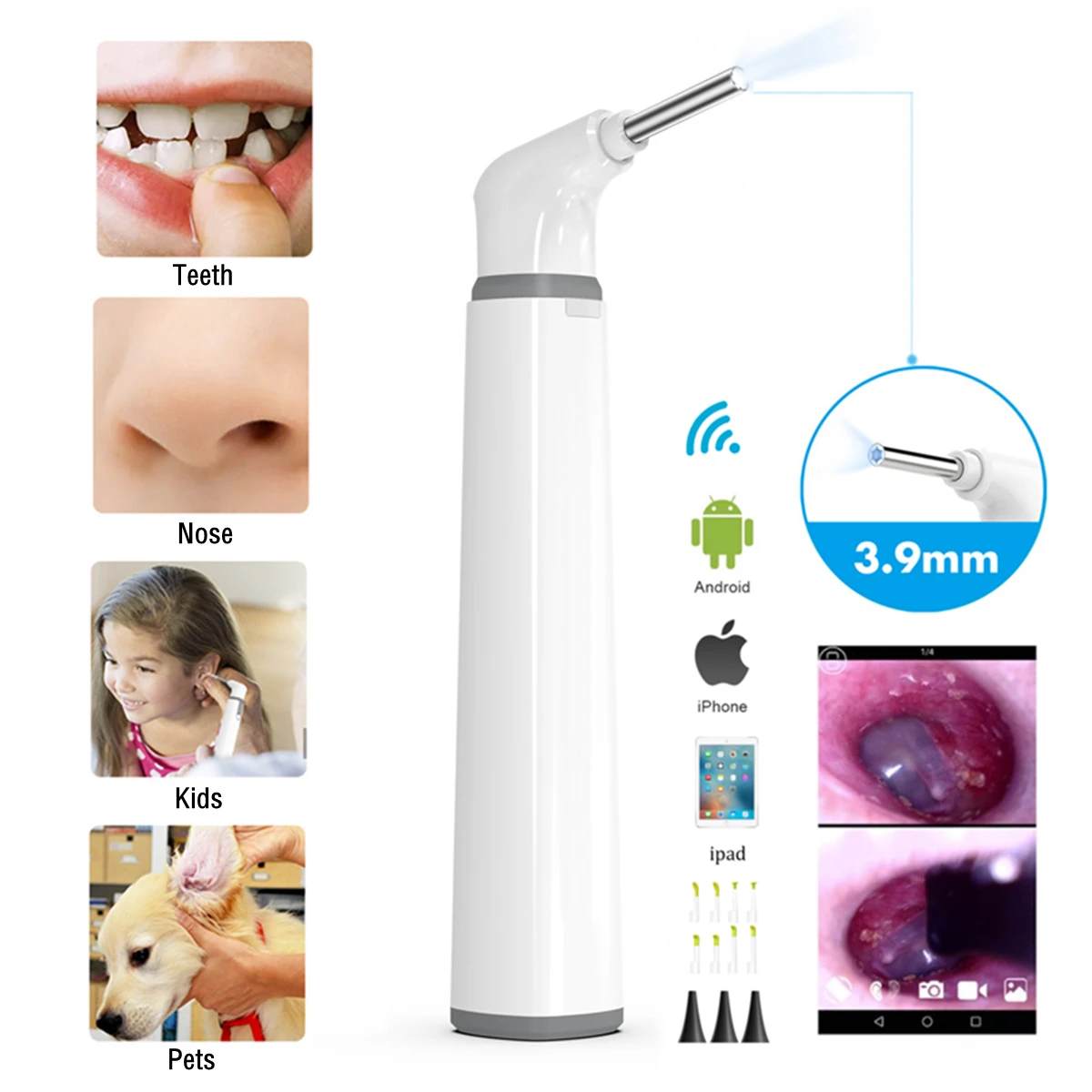 

Wifi Ear Otoscope 3.9mm Smart Wireless Portable Visual Earwax Cleaning Endoscope Camera for iPhone Android Phone iPad