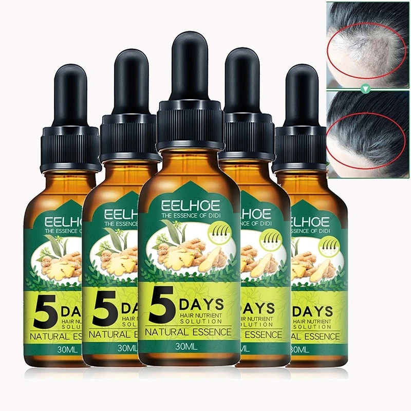

5PCS Ginger Hair Growth Essence Oil Natural Hair Care Essential Anti Hair Fall Oils Treatment Serum Scalp Massage Products 30g