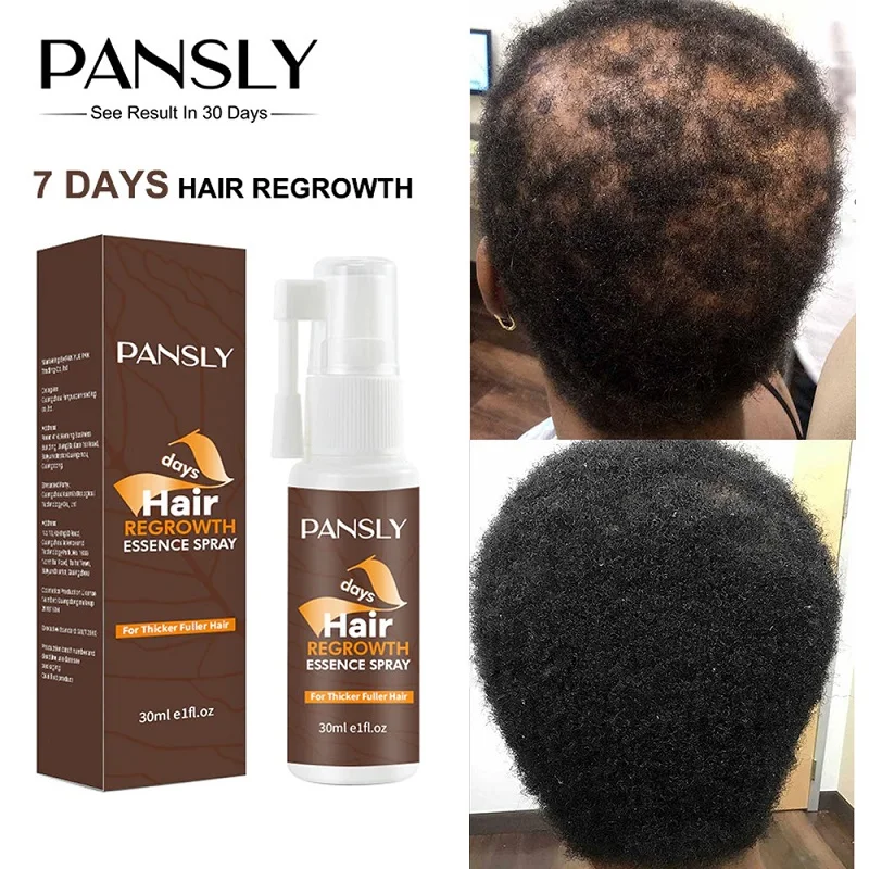 

Hair Growth Products Spray Oil Fast Effective Hair Growth Prevention Hair Loss Serum Scalp Treatment Men Women Hair Care 30ml
