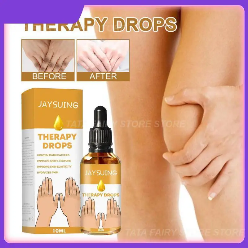 

Жидкость для отбеливания пальцев и суставов, 10 мл