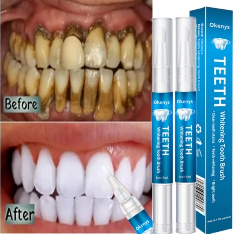 

Teeth Whitening Pen Remover Plaque Stains Oral Hygiene Cleaning Gel Fresh Breath Tooth Whitener Serum Dental Bleach Care Tools