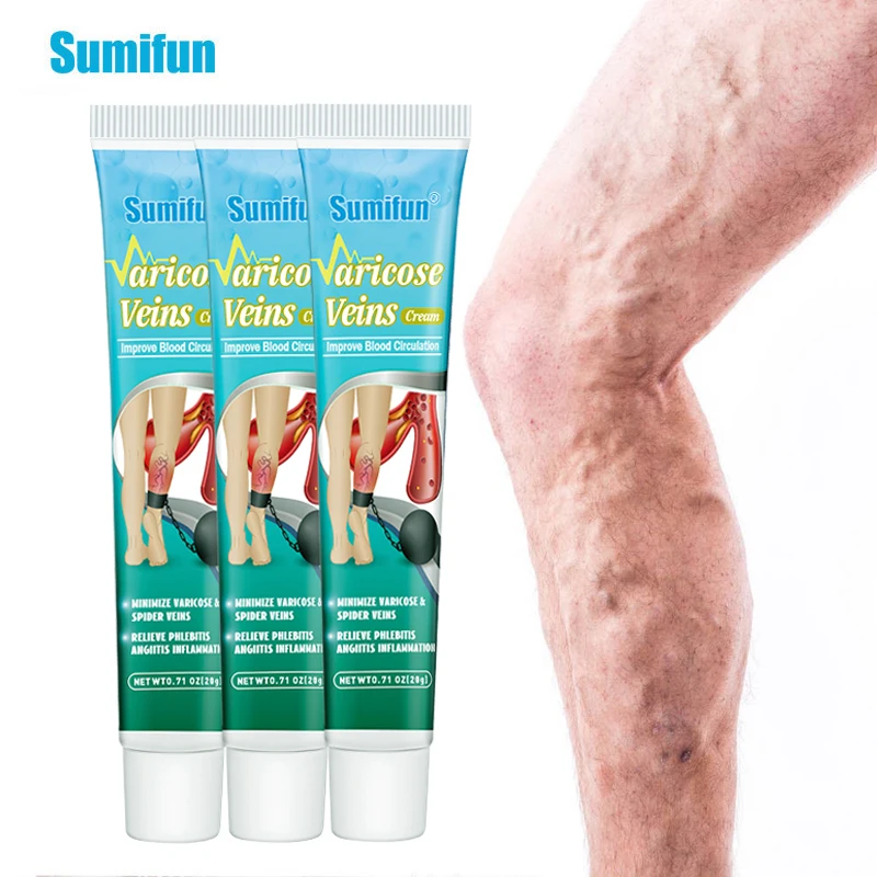 

1Pcs Sumifun New Varicose Vein Cream Phlebitis Vasculitis Health Care Plaster Thigh Varicosity Swelling Pain Relief Ointment