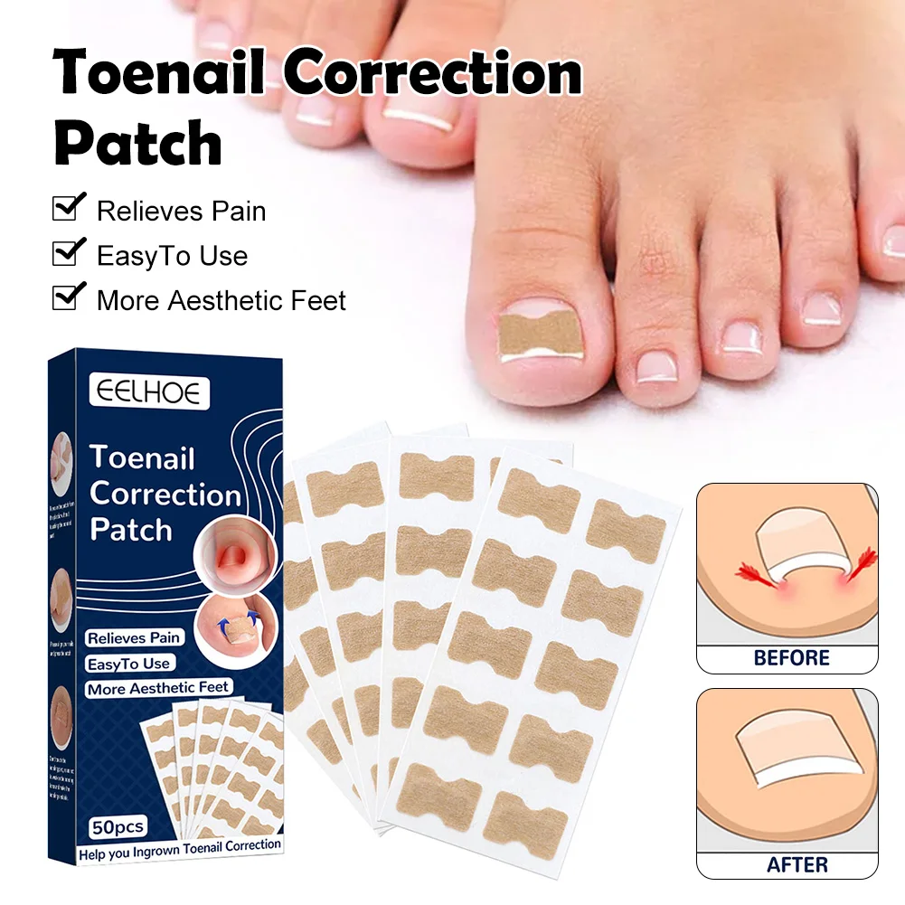 

50pcs Nail Correction Stickers Ingrown Toenail Corrector Patches Waterproof Paronychia Treatment Recover Corrector Pedicure Tool