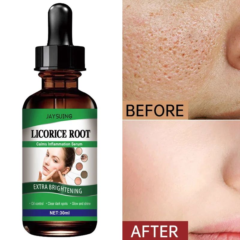 

Сыворотка для лица с экстрактом корня лакрицы, эфирное масло против акне и морщин