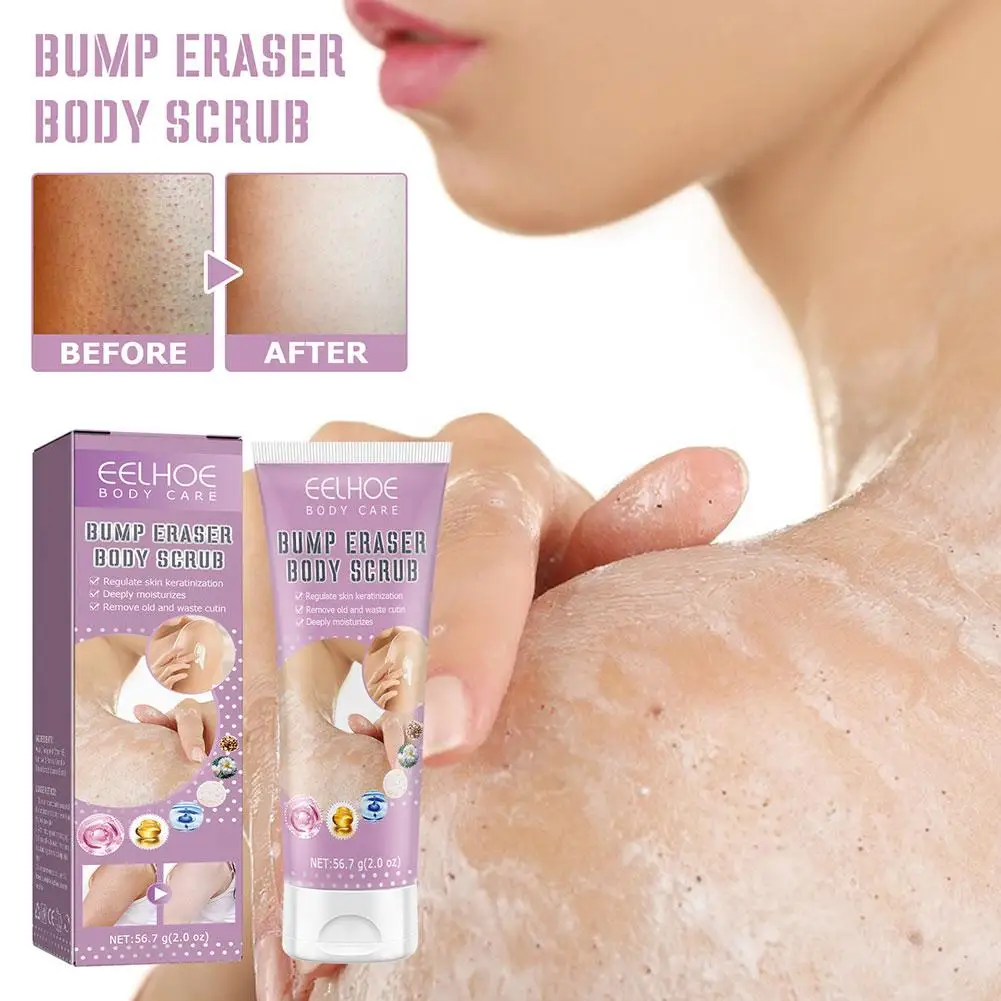 

Scrub Cream Keratosis Pilaris Cream For Strawberry Legs Removal Dark Spot KP Bump Eraser Body Scrub Smooth Lotion R8V9