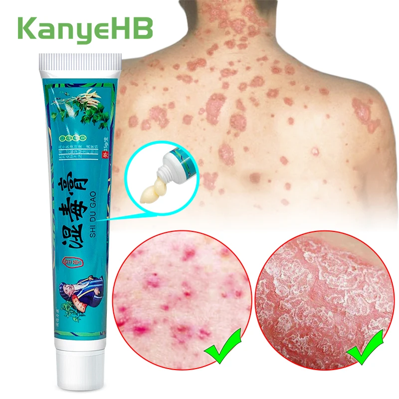 1 шт., крем от псориаза, против зуда