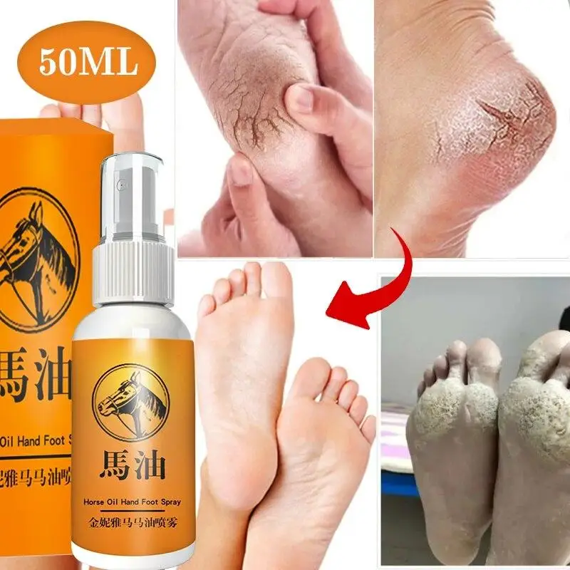 

New Repair Essential Oils Remove Skin Hand and Foot Spray Repair Damaged Horse Oil Beriberi Anti Drying Repair Heel