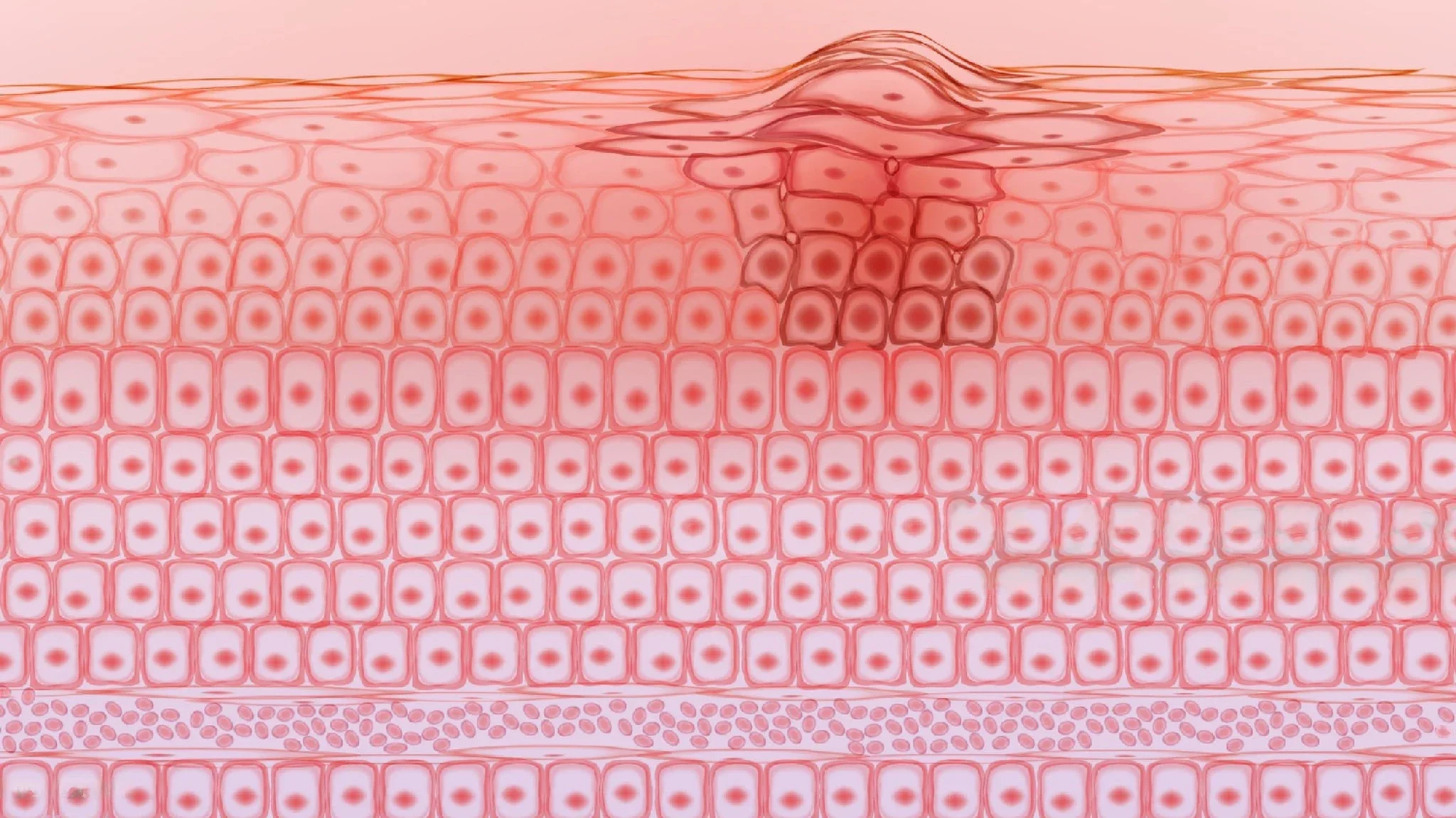 IBOOLO DE-4100 Advance Профессиональный ручной дерматоскоп для диагностики поражений кожи