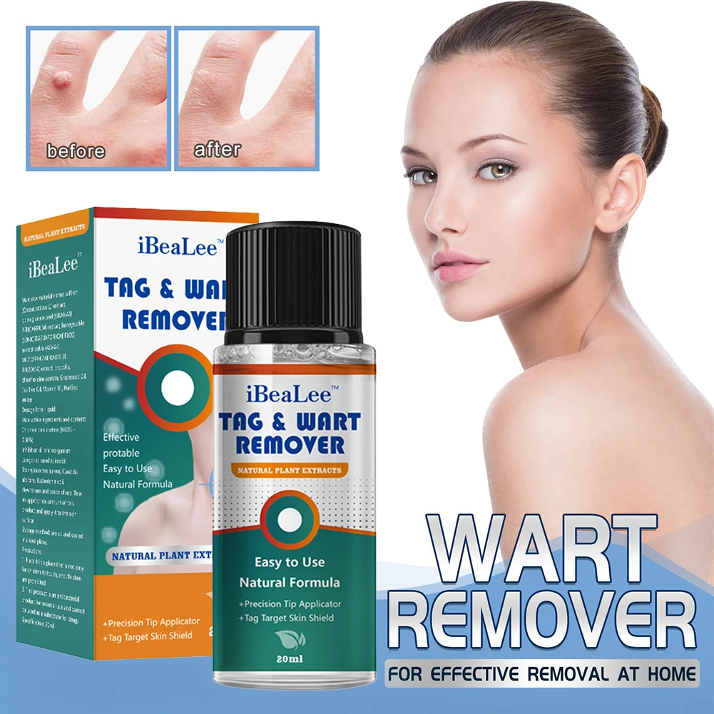 

Skin Tag Remover Serum Painless Skin Tag Mole Wart Removal Essential Oil Natural Face Body Wart Treatment Serum Skin Care 20ml