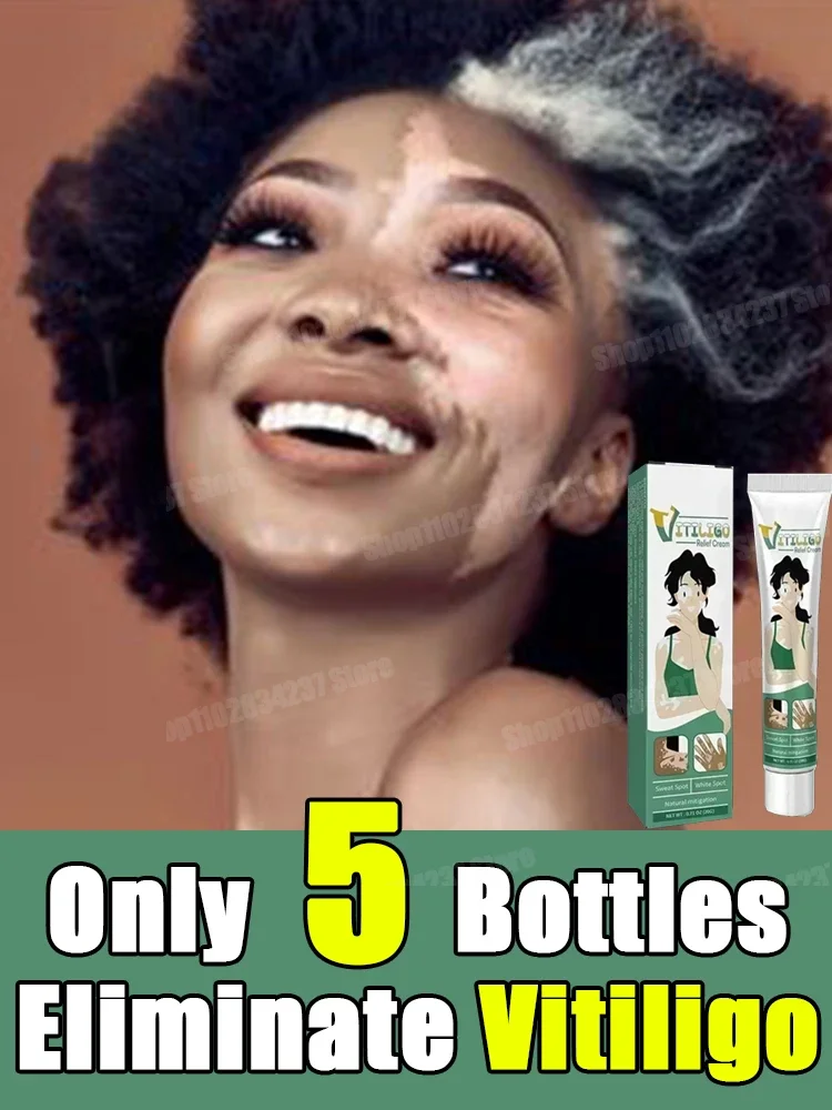 Крем с белой биркой пятна от пота очистка кожи восстановление белых пятен