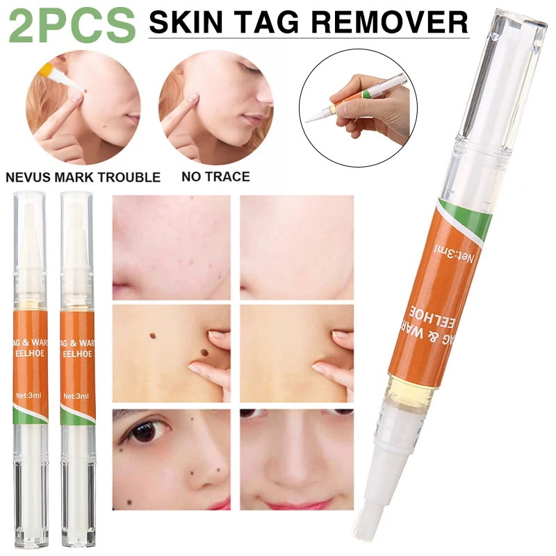 

2 Pcs 3ml Genital Skin Tag Remover Pen Plantar Warts Corns Callus Mole Removal Skin Tag Treatment Body Corn Repair Liquid Beauty