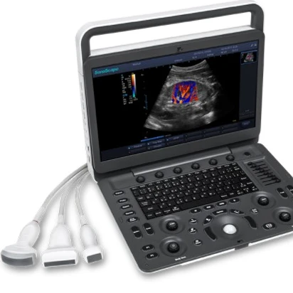 

Medical Ultrasound Instruments Portable Sonoscape E3 manufacture price ultrasound system Professional