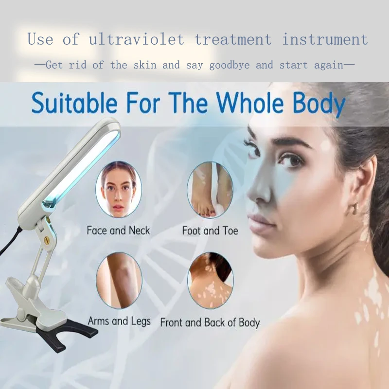 УФ-лампа Гленн Vitiligo UVB 311nm уфв лампы для псориаза ручная узкополосная уфв-лампа