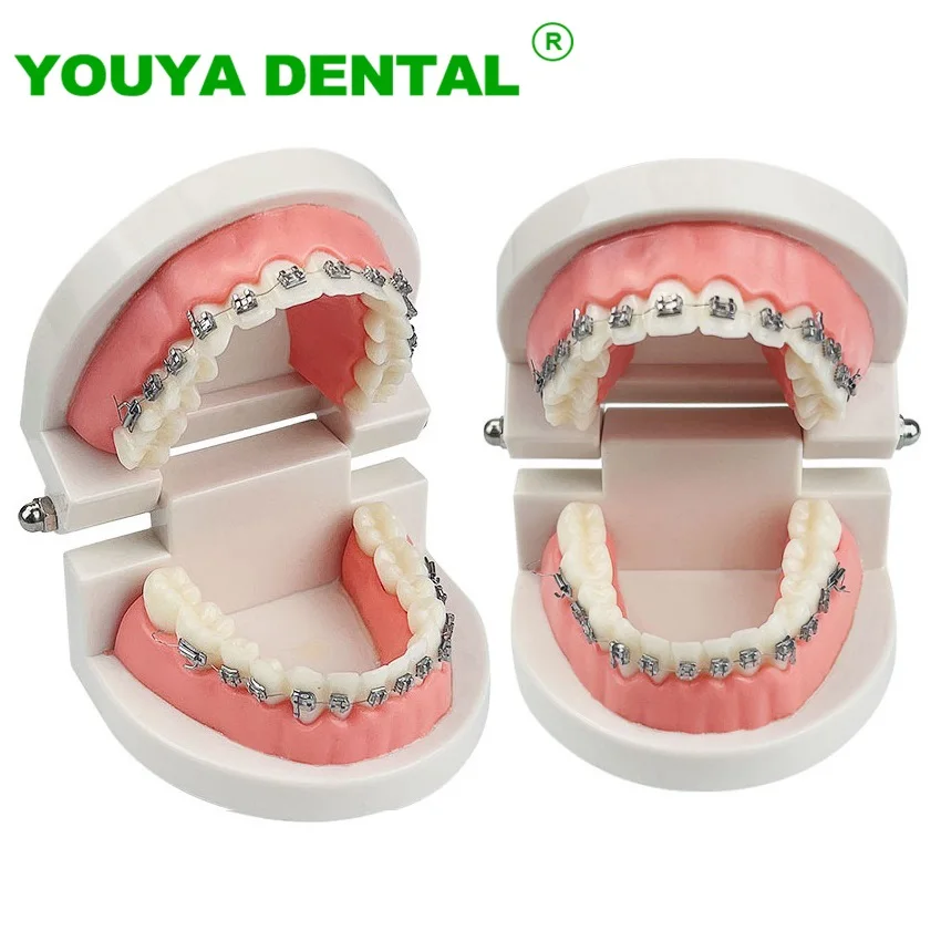 

Dental Orthodontic Teeth Model With Ortho Metal Bracket Braces Arch Wire Ligature Ties Dentist Teaching Study Demonstration Tool