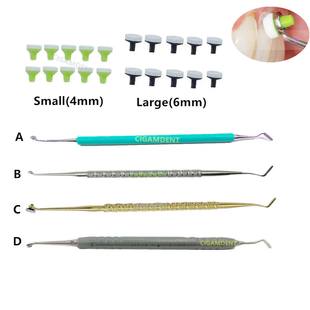 

Dental Instruments Composite Resin Filling Spatula Trimmer Ivoclar Vivadent OptraSculpt Light-Cure Handle Fast Quick Foam Pads