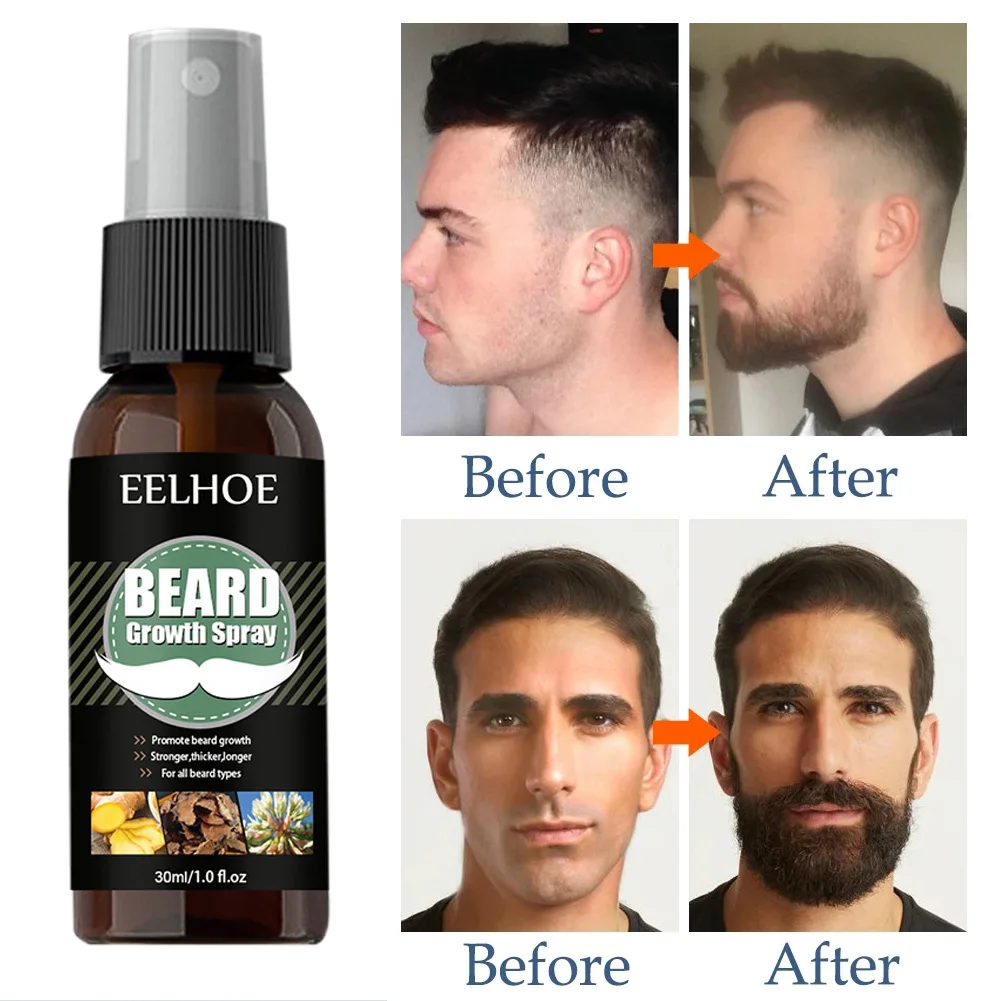 

Beard Growth Spray Set Mustache Accelerator Serum for Thicker Fuller Beard Moisturizing 30ml Beard Hair Growth Spray with Roller