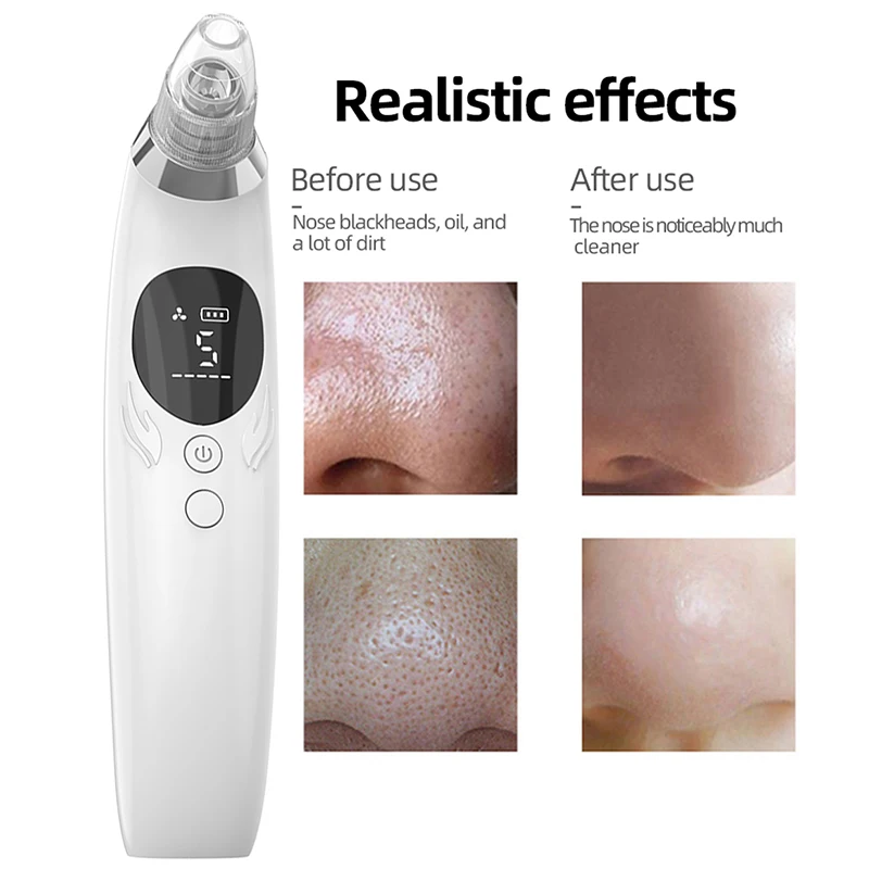 Аппарат для очистки пор устройство удаления черных точек вакуумное на лице и